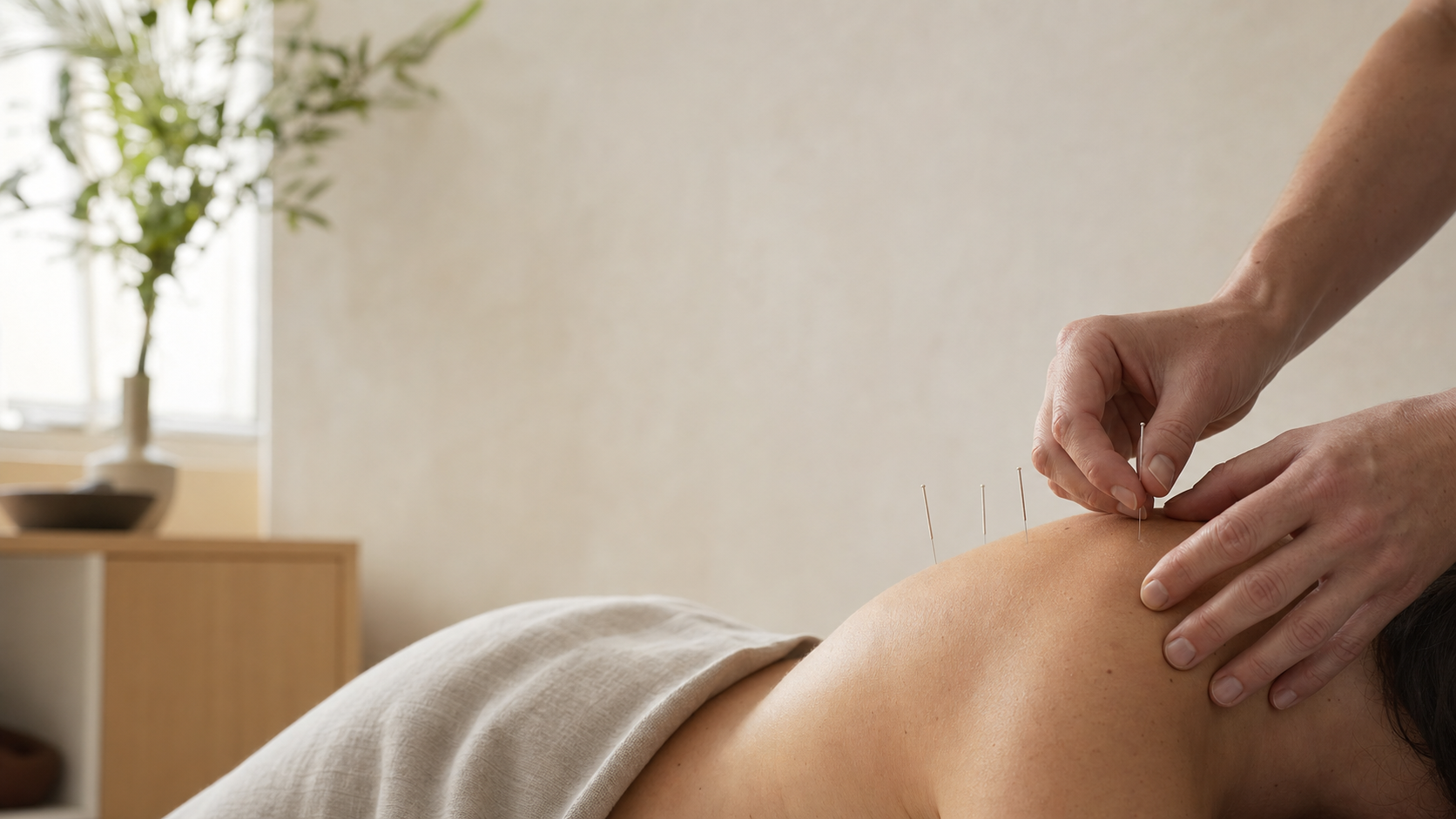 Calm acupuncture clinic room for consultation-led treatment in London